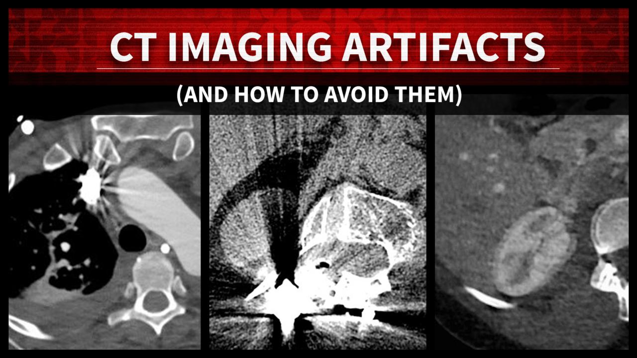 Imaging Artifacts – 3D And Quantitative Imaging Laboratory