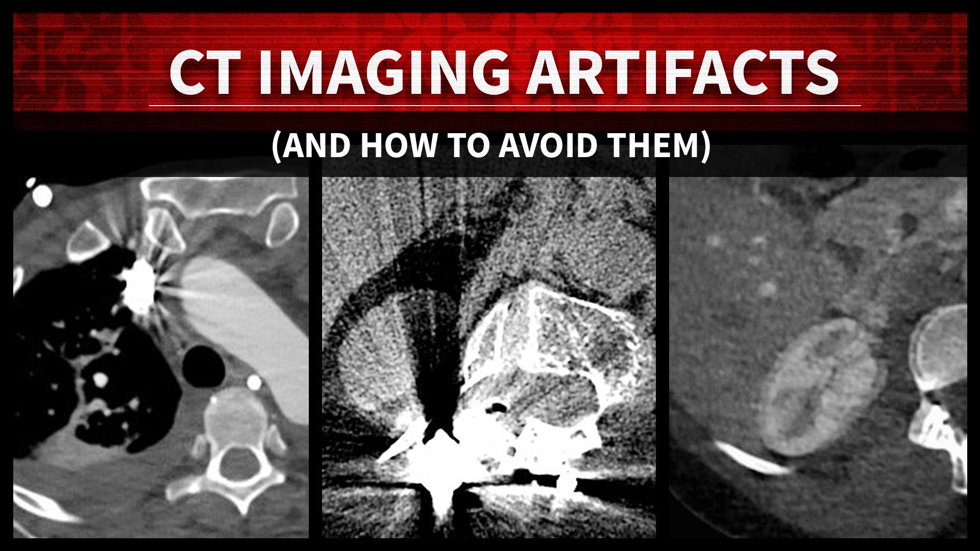 CBCT Artifacts | Basic CBCT| CBCT basic understanding | Cone beam computed  tomography - YouTube